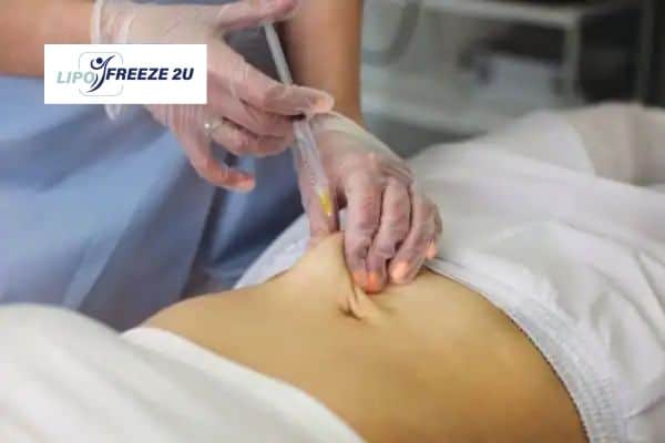 How Does Aqualyx Fat Dissolving Injection Work to Break Down Fat Owsestry?