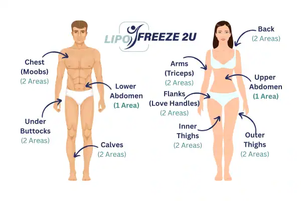 Areas you can have fat freezing treatment Owsestry