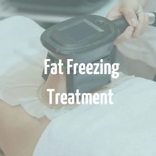 fat freezing treatment Owsestry