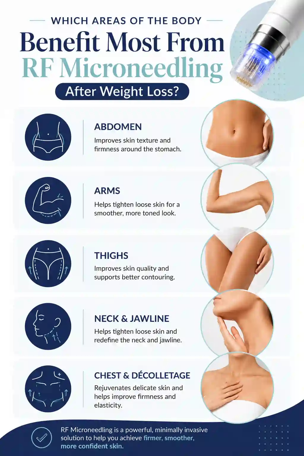 Which Areas of the Body Benefit Most From RF Microneedling After Weight Loss Owsestry